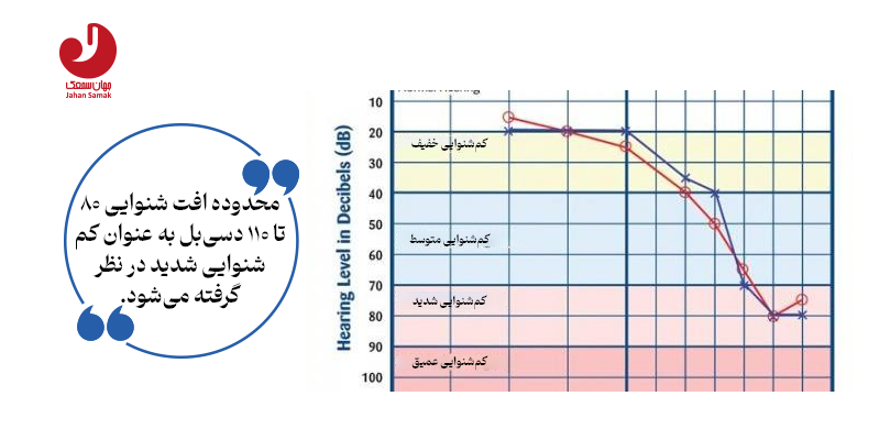 محدوده کم شنوایی شدید که به سمعک نیاز است